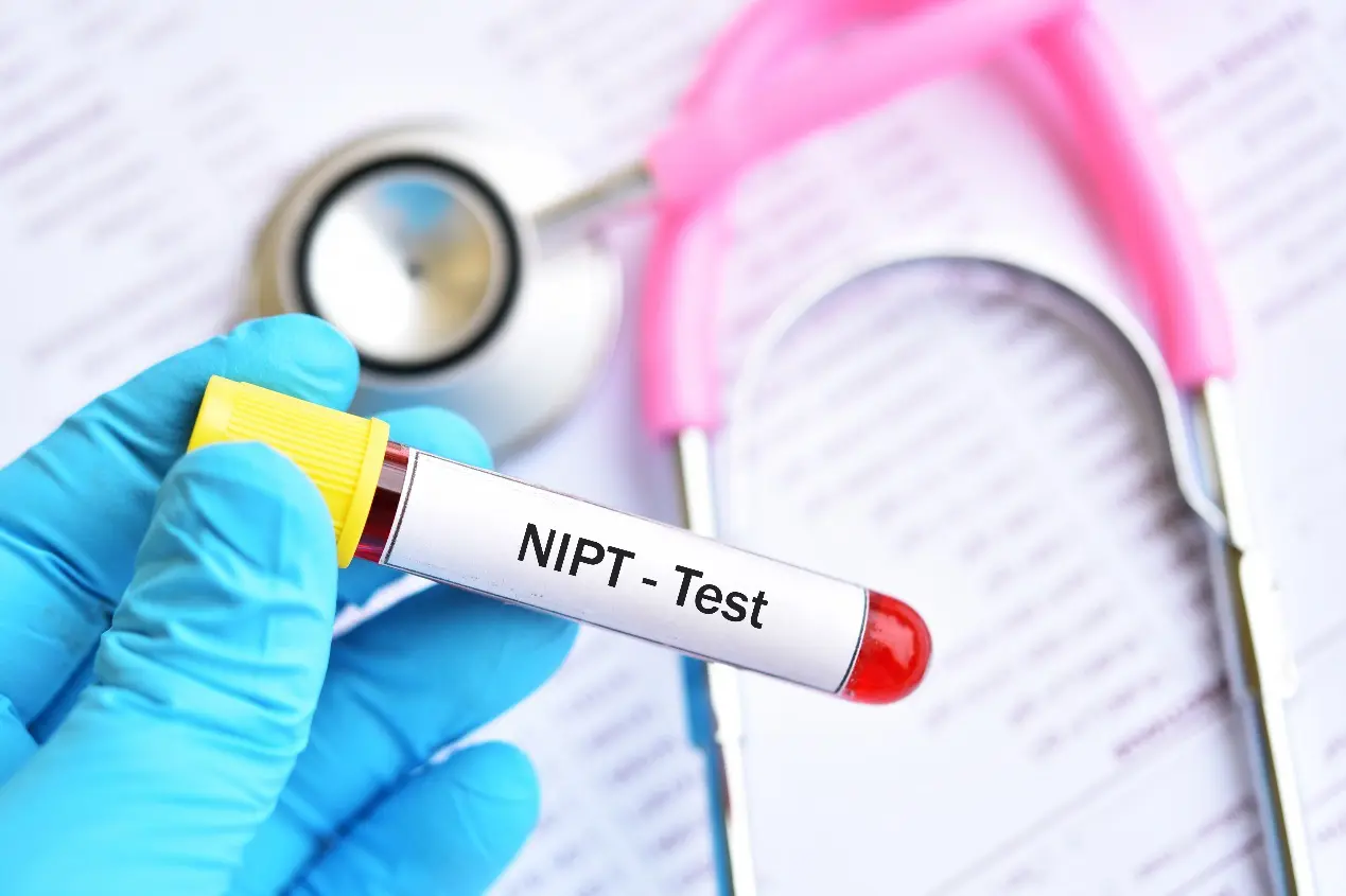 NIPT Μη Eπεµβατική προγεννητική εξέταση του εμβρύου